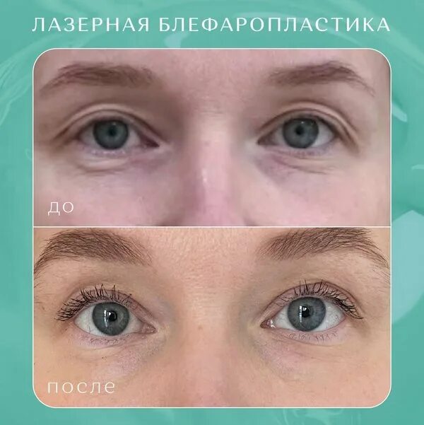 Ол эстетик лаб. Ол эстетик лаб