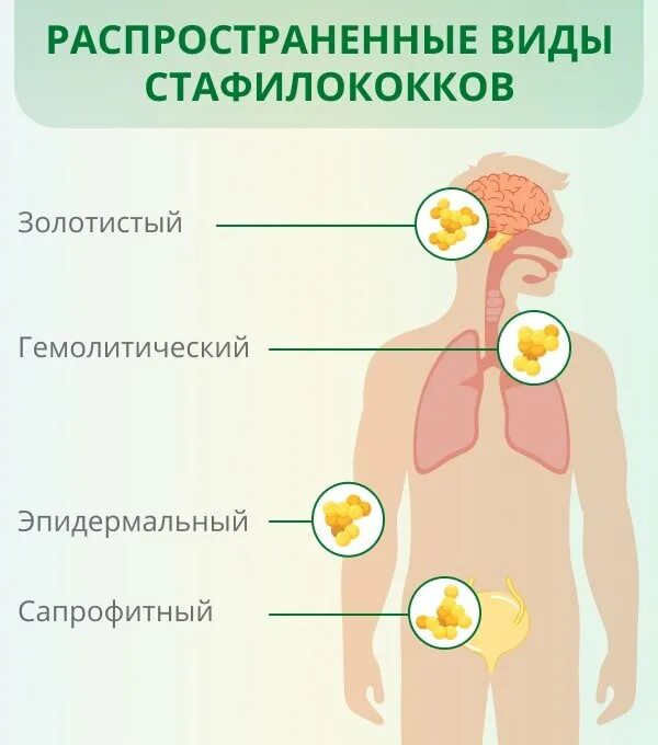 Золотистый стафилококк прыщи. Стафилококк на коже человека. Золотистый стафилококк симптомы. Стафилококк симптомы у женщин.