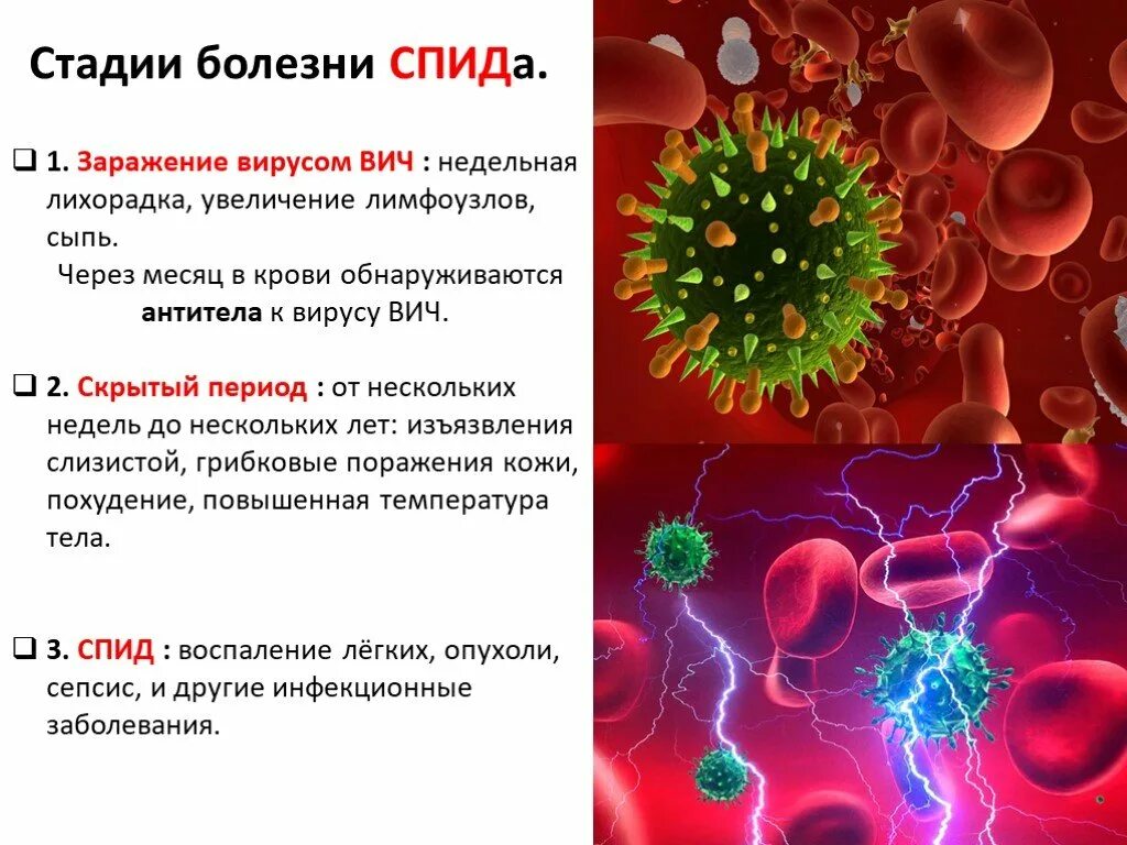 Иди спида. Вирусные заболевания ВИЧ. СПИД презентация.