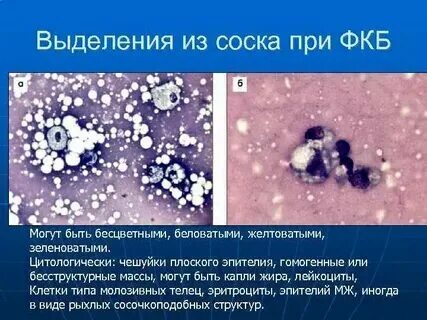 Выделения из сосков во время