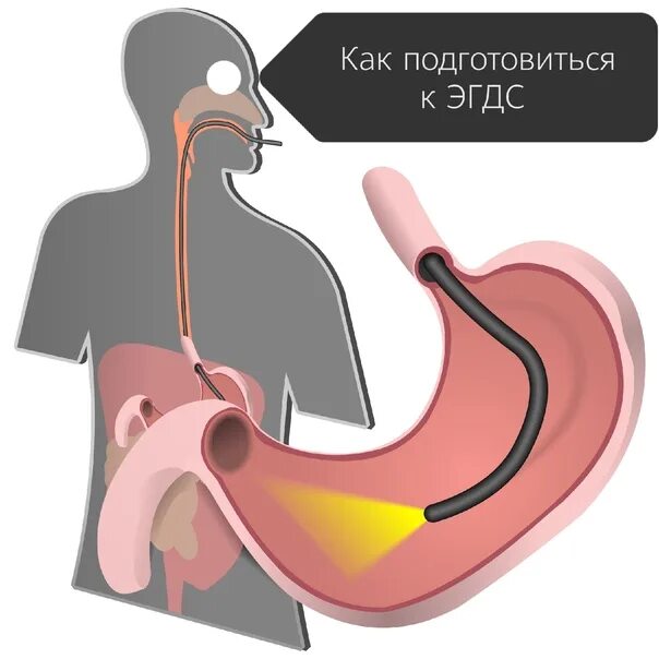 Эгдс и фгдс в чем разница что. Эзофагогастродуоденоскопия диагностическая. Эзофагогастродуоденоскопия с биопсией. Эзофагогастродуоденоскопия схема.