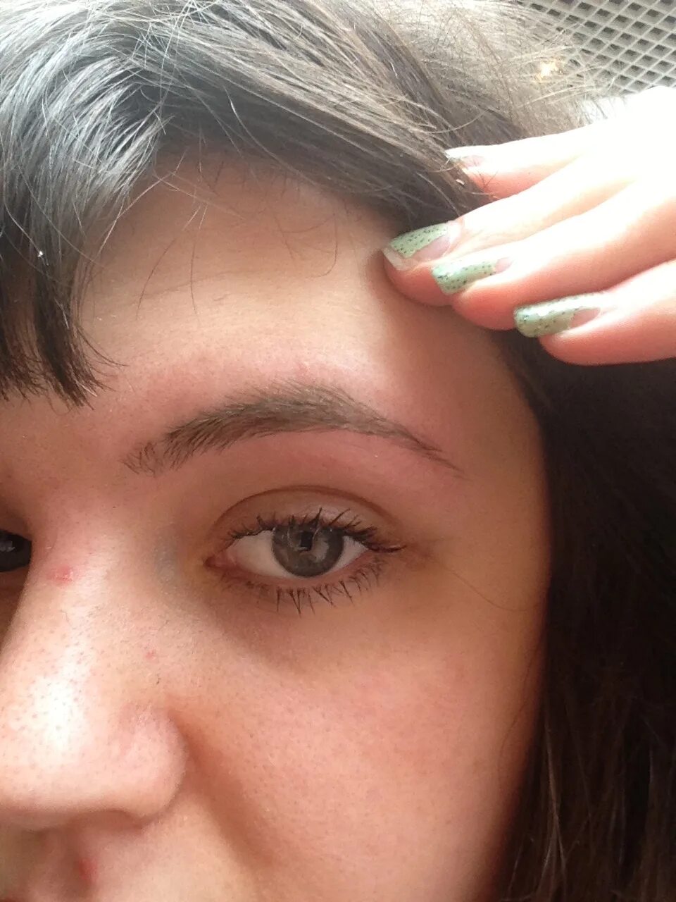 Белеют брови. Седые брови. Алопеция бровей и ресниц. Седая ресничка. Тонкие брови.