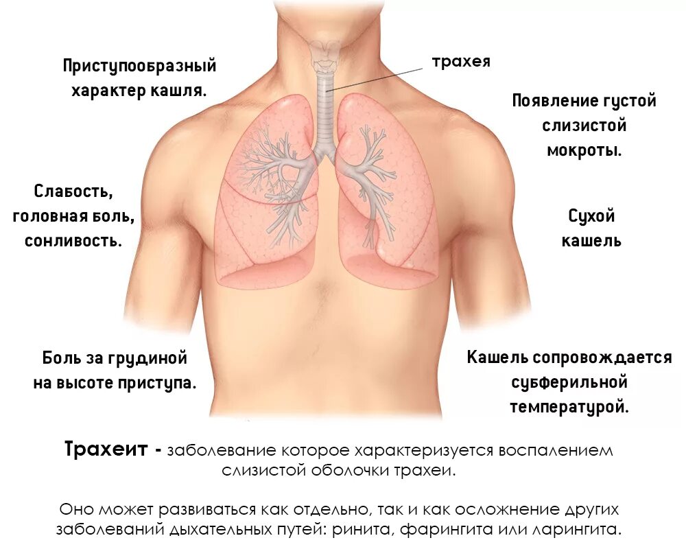 Трахеит бронхит пневмония. Воспаление бронхов и легких. Болят легкие при бронхите. Какие боли при пневмонии