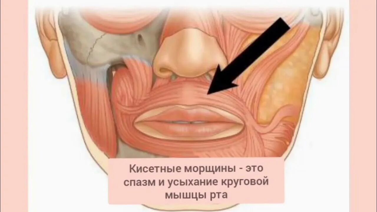 Губы мышцы рта. Кисетные морщины и круговая мышца рта. Круговая мышца рта анатомия.