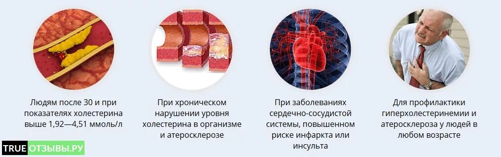 Симптомы повышенного холестерина. Холестерин заболевания. Симптомы повышенного холестерина у мужчин. Влияние высокого холестерина. Высокий холестерин у мужчин симптомы.