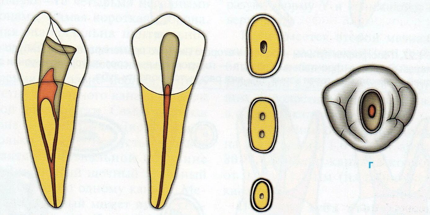 Топография устьев корневых каналов молочных зубов. Топография устьев корневых каналов зубов верхней и нижней челюсти. Топография устьев корневых каналов 26 зуба. Топография пульповой камеры и корневых каналов. Формы корневых каналов