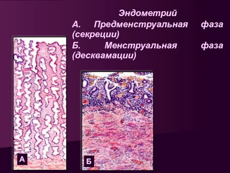 Эндометрий фазы пролиферации