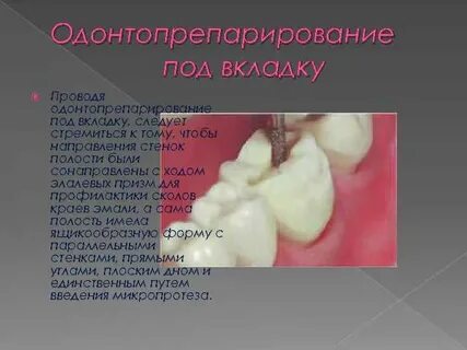 Препарирование это