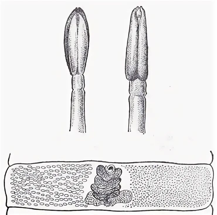 Строение яйца широкого лентеца. Сколекс дифиллоботриоза.