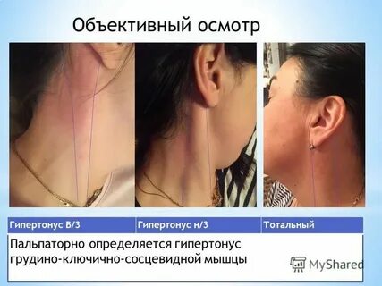 Увеличение справа