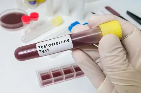 Testosterona afeta função cerebral, hipertrofia e libido saúde ge