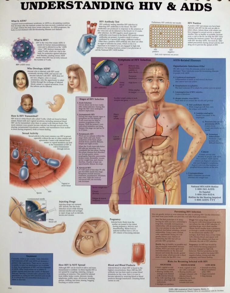 СПИД наглядные пособие. Плакаты вс кожными заболеваниями. Вич пособия