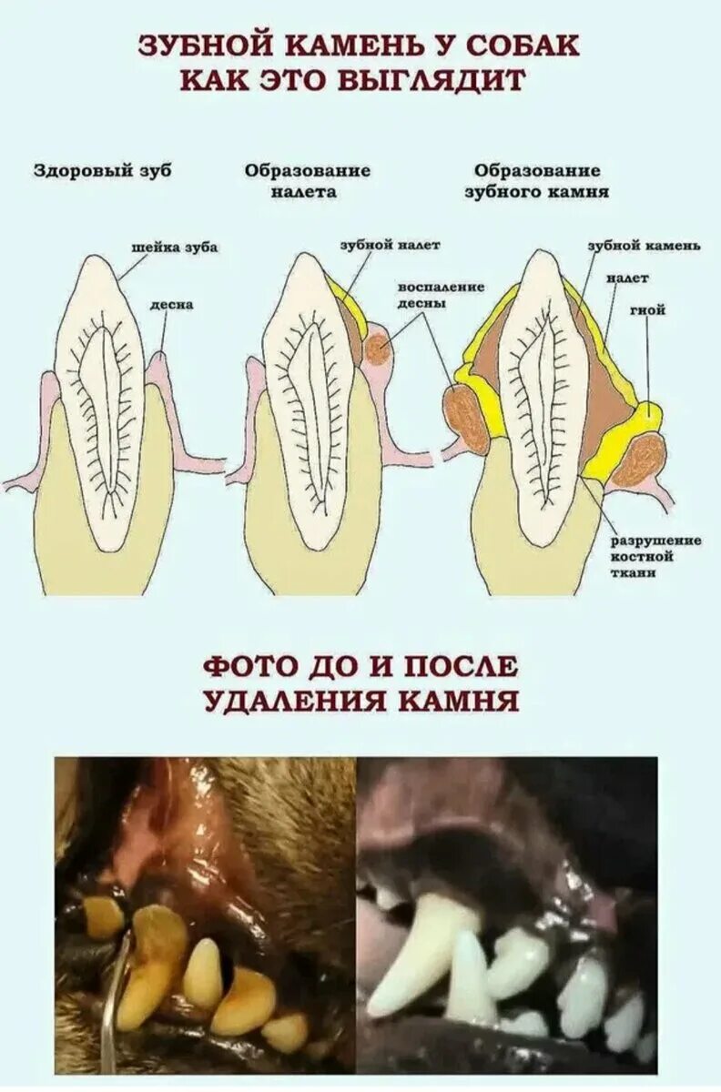 Камень убрать той. Зубной камень у подростка. Поддесневой зубной камень. Камень убрать той. Полировка камня.