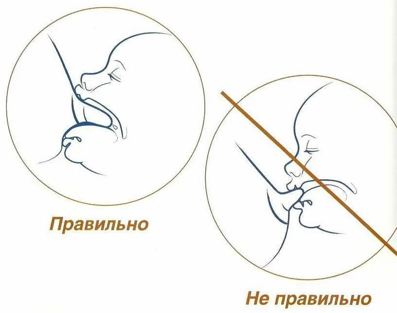 Как правильно прикладывать ребенка. Правильное прикладывание при кормлении грудью. правильное прикладывание новорожденного ребенка к груди. правильный захват при грудном вскармливании новорожденного ребенка. правильное прикладывание ребенка при грудном вскармливании.
