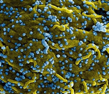 Marburg virus