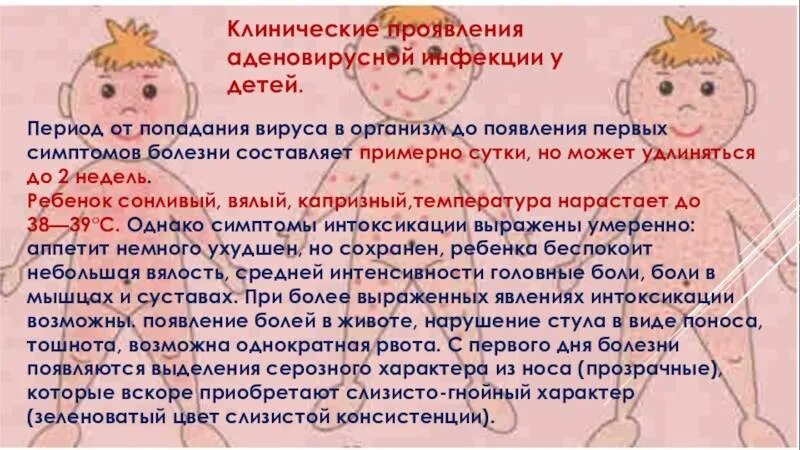 Аденовирусная инфекция у детей. Клинические проявления аденовируса. Аденовирусная инфекция проявления. Аденовирусная инфекция у детей симптомы.