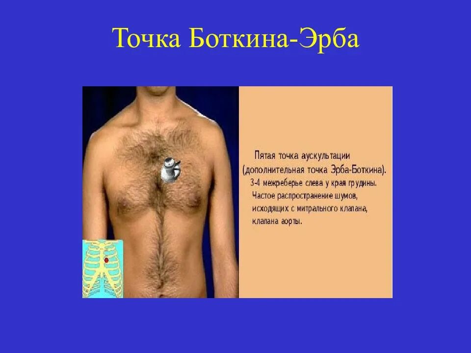 Точка боткина. Аускультация точки боткина эрба. Аускультация сердца боткина эрба. Точки аускультации сердца. Аускультация сердца точка боткина эрба.
