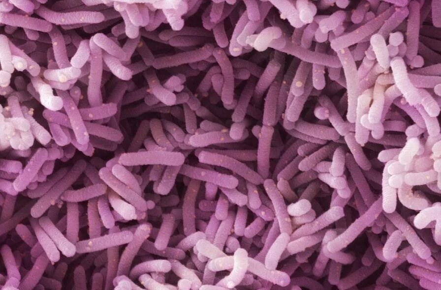 Палочка бифидобактерии. Лактобациллы (Lactobacillus). Lactobacillus – (молочнокислые палочки) -. Lactobacillus Acidophilus в микроскопе. Лактобактерии casei.