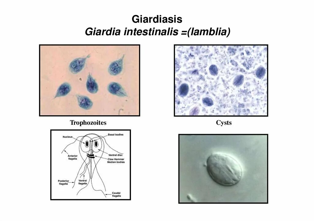 Гиардия лямблия. Giardia lamblia жизненный цикл. Трофозоиты Giardia intestinalis.