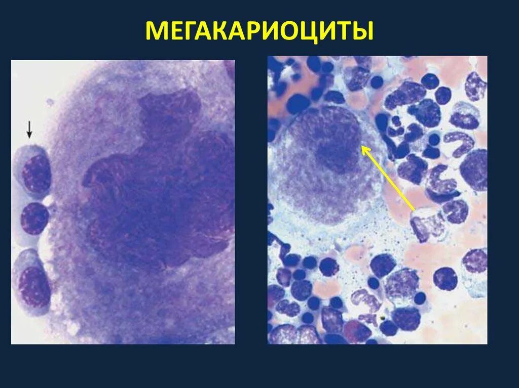 Мегакариоцит цитоплазма. Мегакариоцит цитоплазма