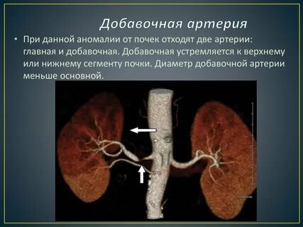 Уровень отхождения почечных артерий