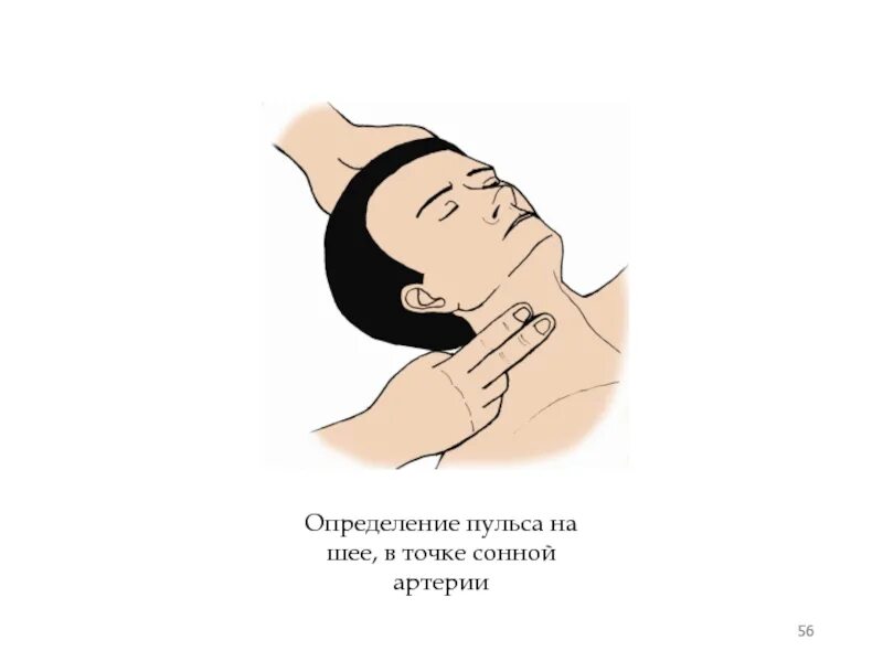 Как определить наличие пульса на сонной артерии. Отсутствие пульса на сонных артериях определяется. определение пульса на сонной артерии. оценка пульса на сонной артерии.