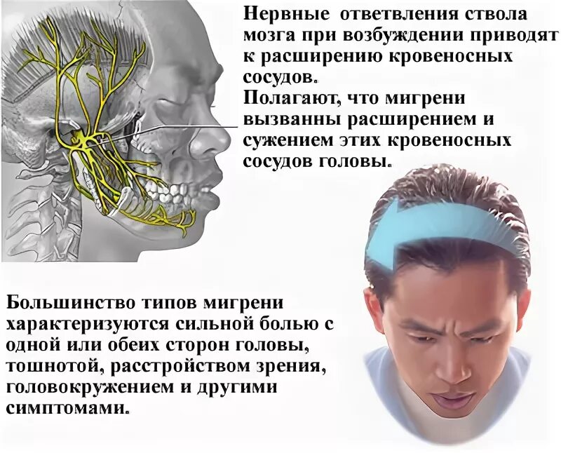 Сильная боль лобной