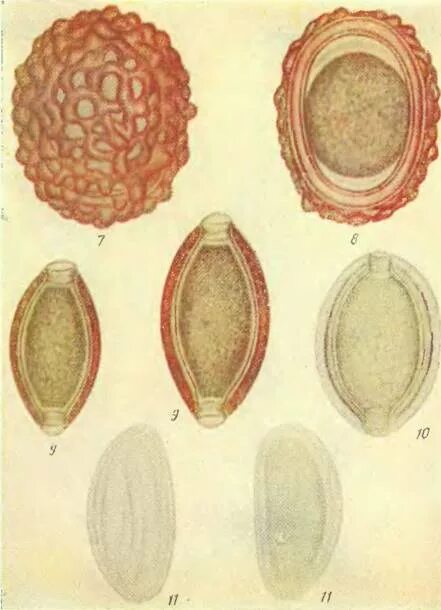 Яйцо паразита. Яйца гельминтов аскариды. Ascaris lumbricoides яйца микроскоп. Яйца гельминтов микроскопия атлас. Яйца аскарид в микроскопе