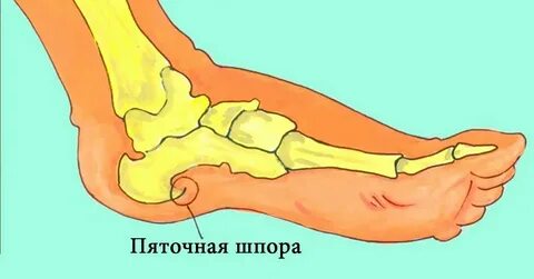 Пятка это где