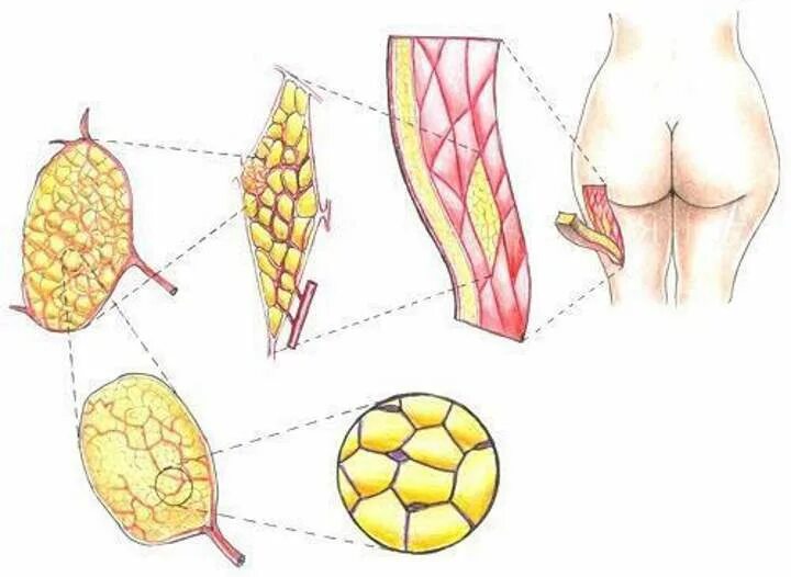 Целлюлит схема. Целлюлит в разрезе. Жировая клетка адипоцит. Жировая ткань живота. Адипоциты жировой ткани.