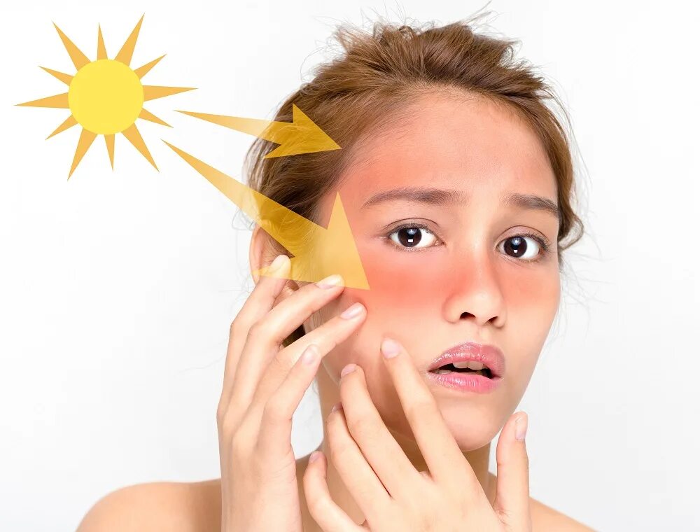 Защита кожи. Защита кожи от ультрафиолетовых лучей. Воздействие УФ лучей на кожу. Влияние ультрафиолетовых лучей на кожу. Солнечный разрушить