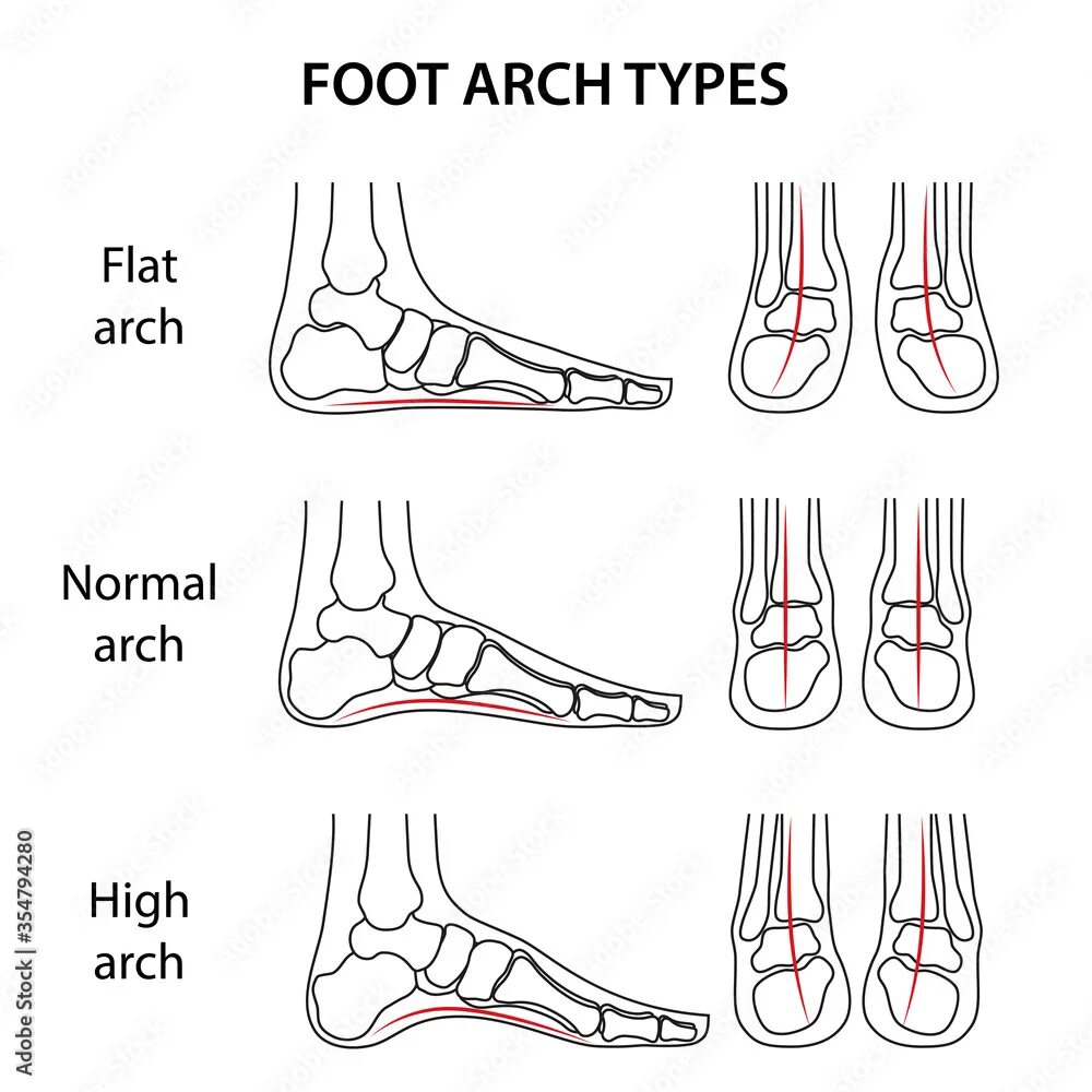 Сетки high arched feet. Hollow foot. Ступни high arches. Foot arch. Arch feet.