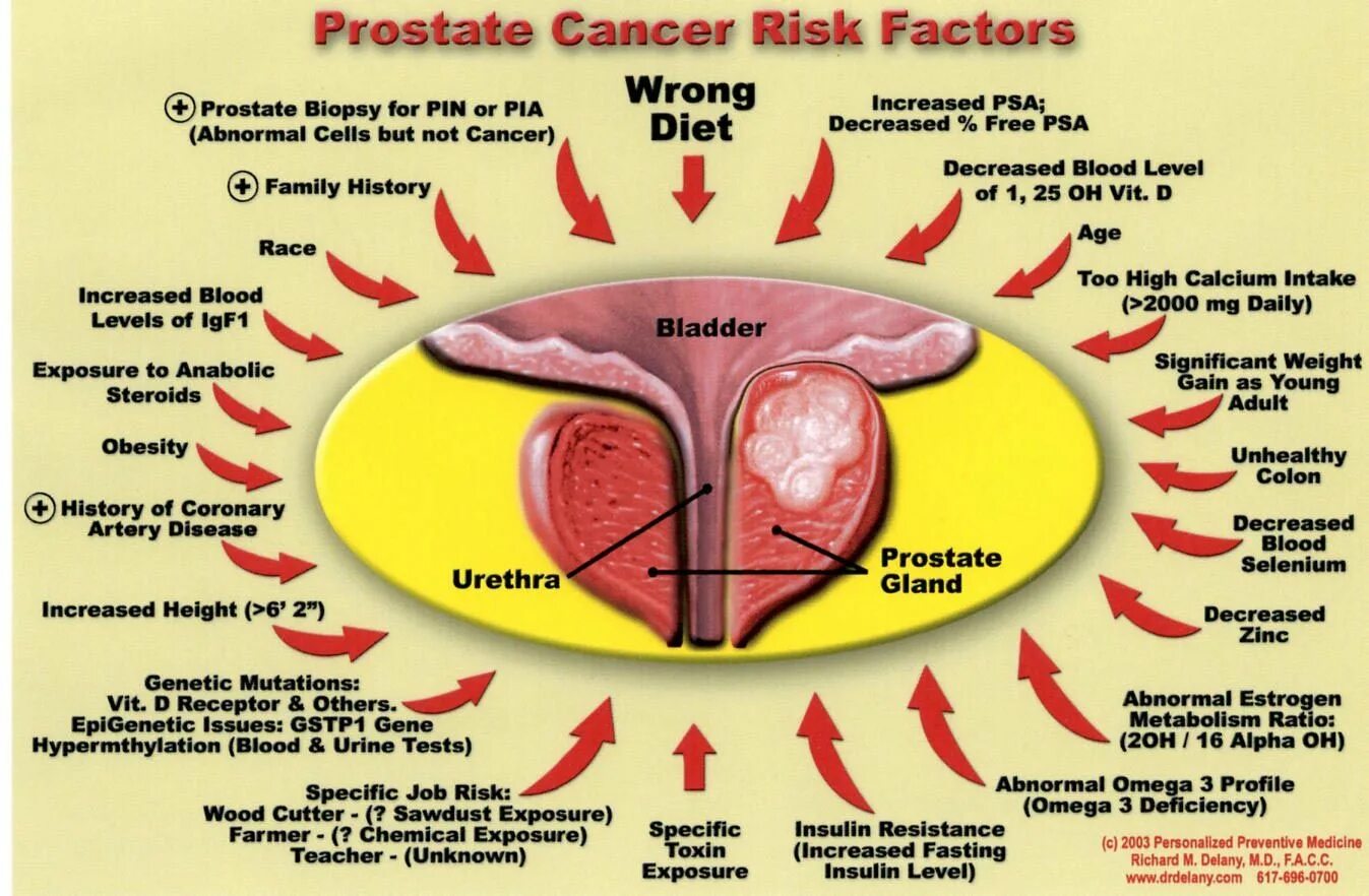 Рак простаты сколько стадий. Prostate Cancer risk Factors. Risk Factors of Cancer. Prevention of prostate Cancer.