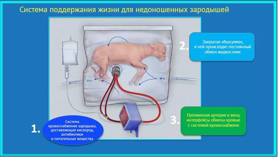 Искусственная матка для вынашивания ребенка. Ребенок выращенный в искусственной матке.