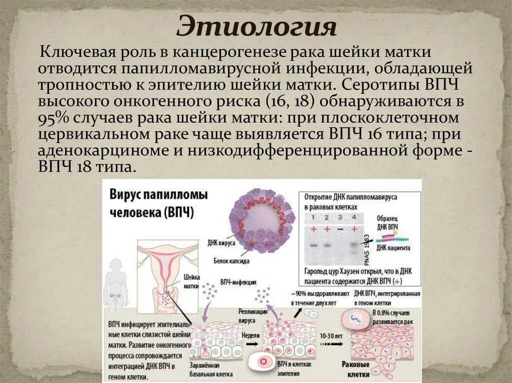 Вирус рака шейки матки. Папиллома вирусная инфекция.