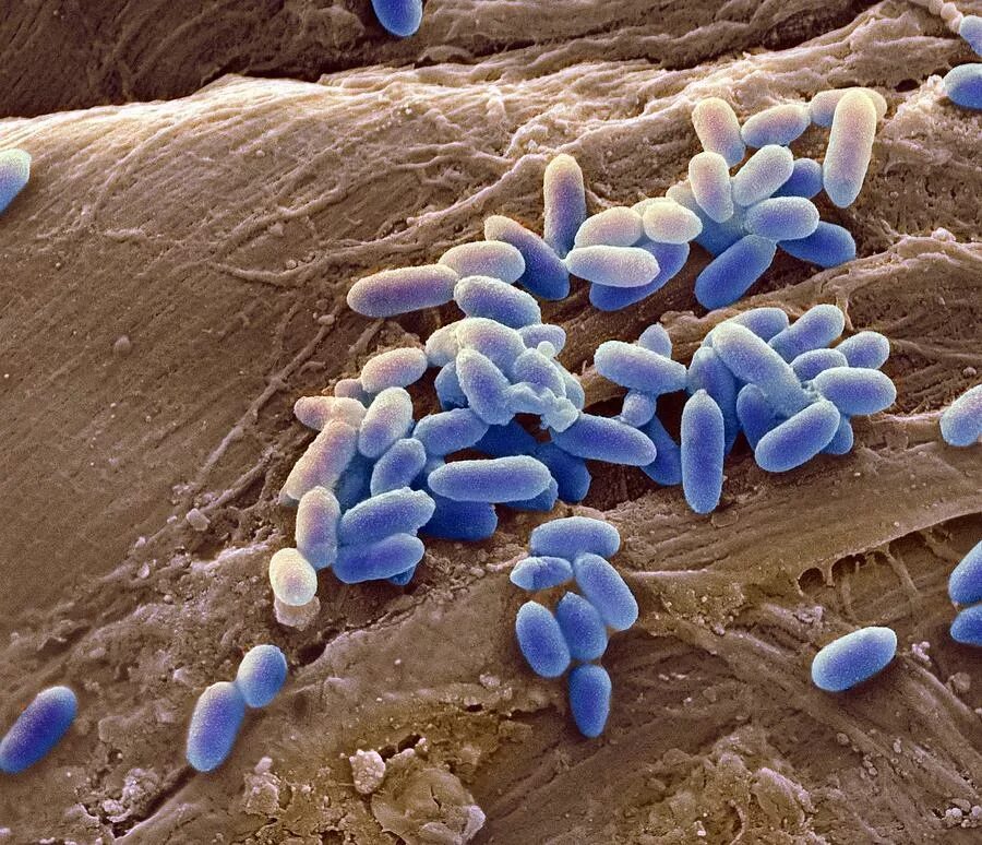 Гнойная бактерия. Бактерия Pseudomonas aeruginosa. Pseudomonas aeruginosa (синегнойная палочка). Бактерия псевдомонас аэругиноза что это. Синегнойная палочка под микроскопом.