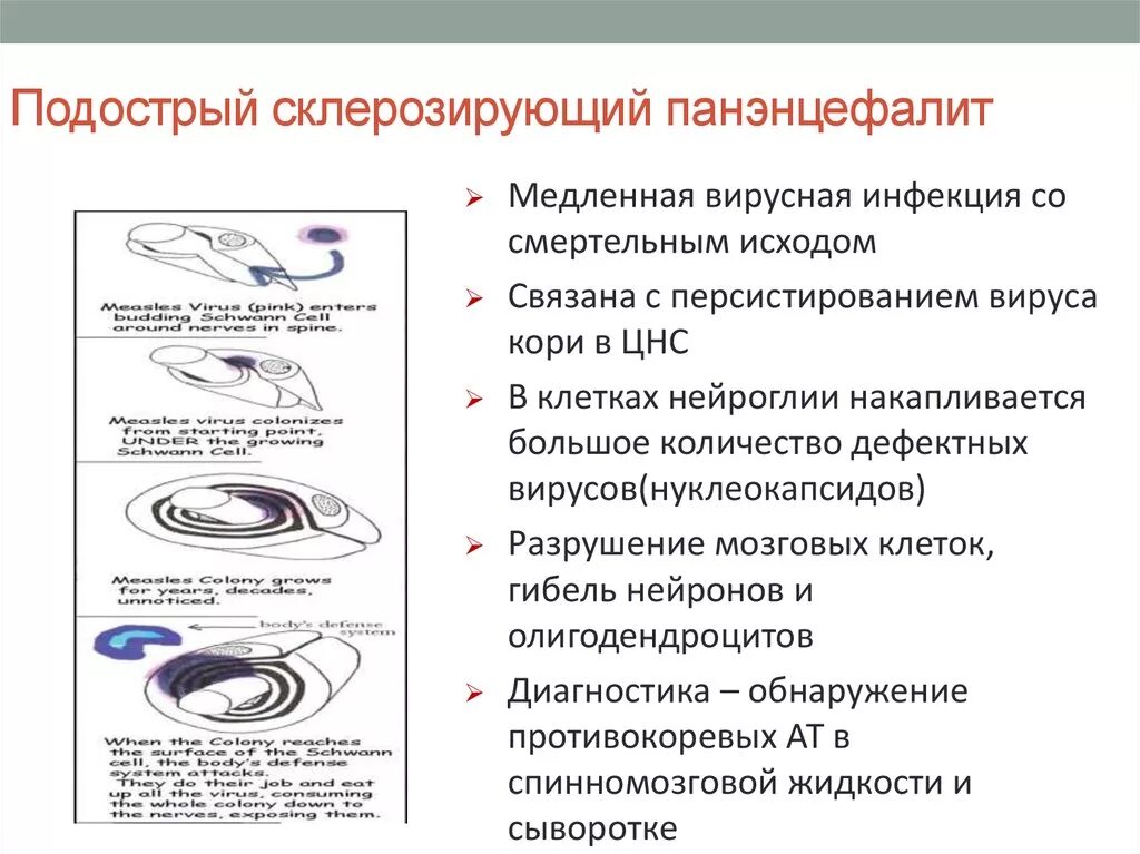 Подострый склерозирующий панэнцефалит. Подострый склерозирующий панэнцефалит патогенез. подострый коревой склерозирующий панэнцефалит. подострый склерозирующий панэнцефалит при кори. подострый склерозирующий панэнцефалит этиология.