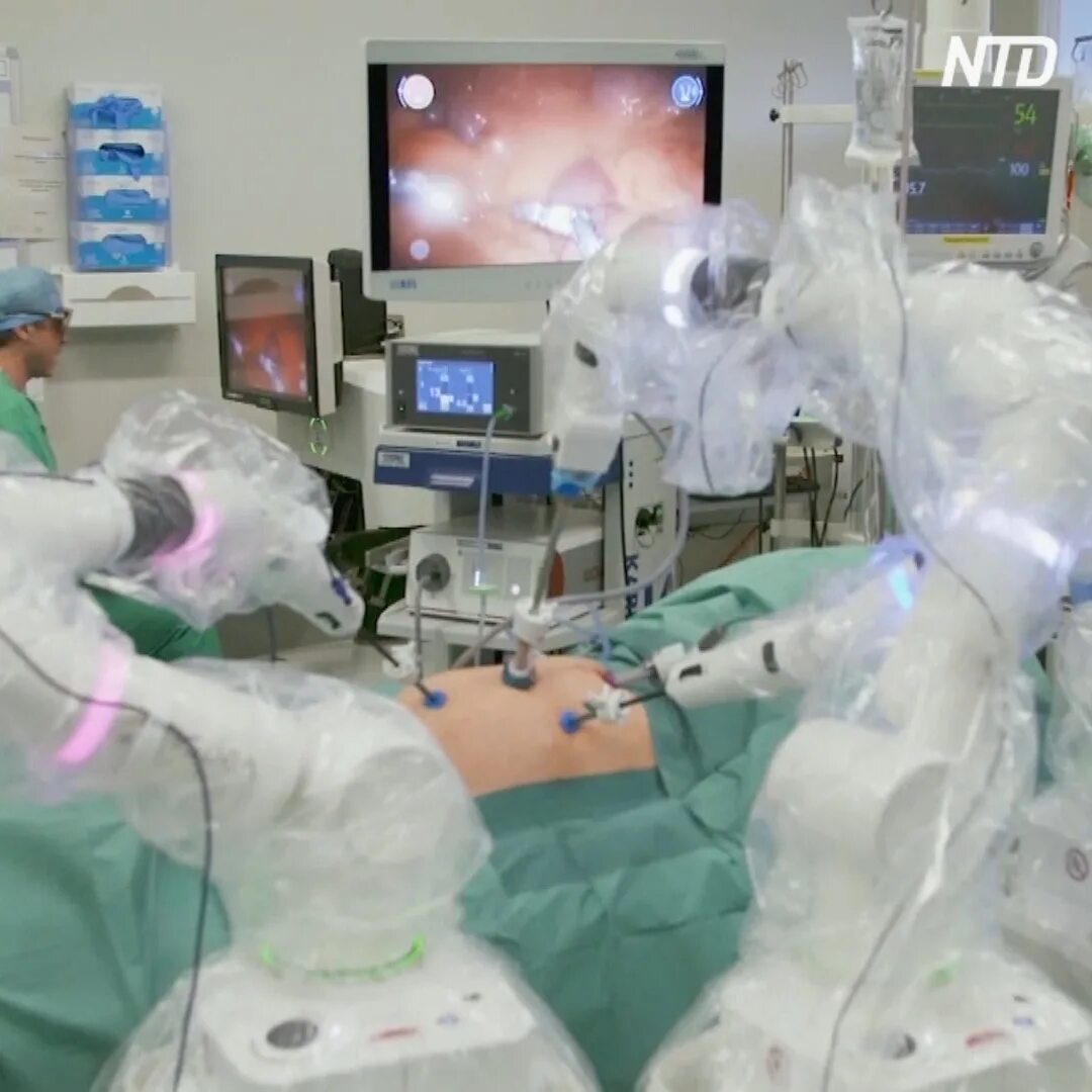 Робот версус хирургический. Лапароскоп операции робот. Выполнена 1000 операция