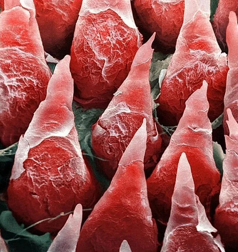 Tongue Surface Photograph by Clouds Hill Imaging Ltd/science Photo Library Human