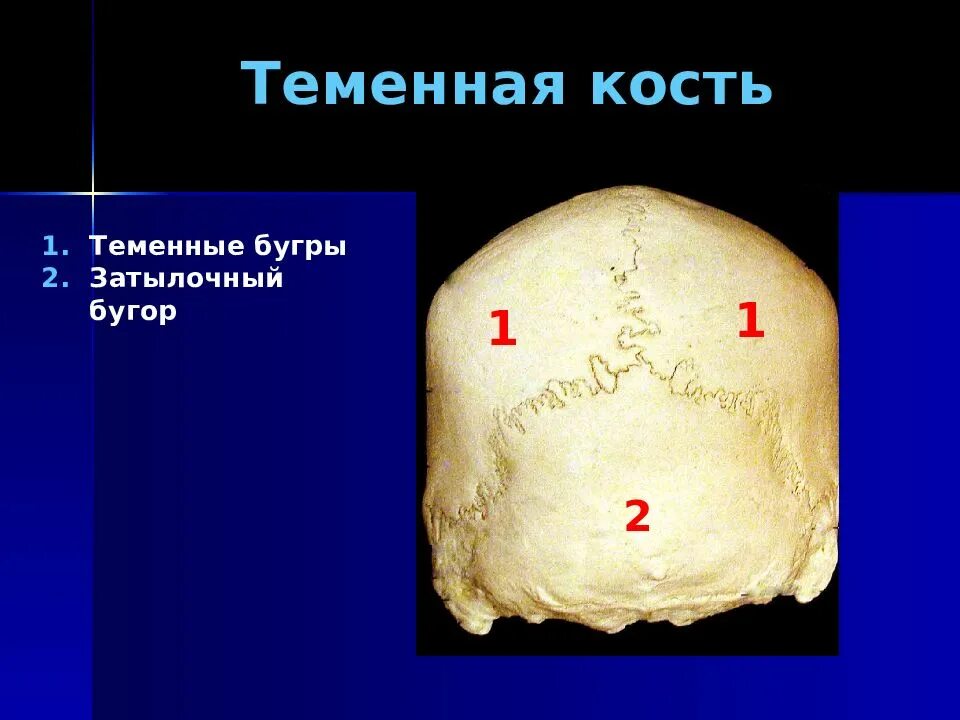 Теменная кость находится. Бугор теменной кости. Части теменной кости черепа. Теменная кость.