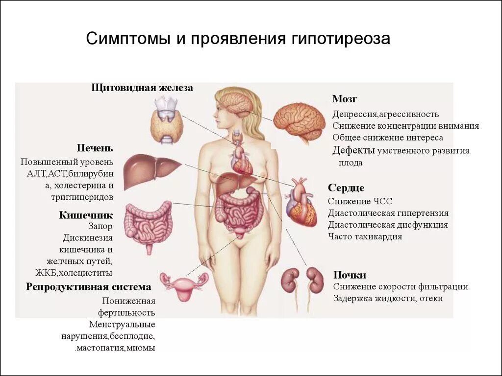 Последствия гипотиреоза у женщин. Гипофункция щитовидной железы симптомы. Гипотиреоз щитовидной железы.