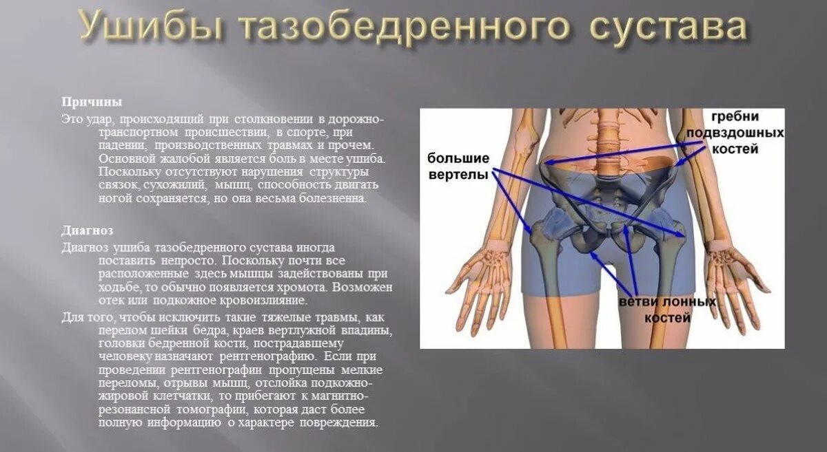 Боль в бедренном суставе. Боль в тазобедренном суставе при ходьбе. Боль в тазобедренном суставе причины. Тазобедренный сустав болит.