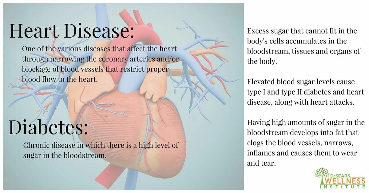 Heart disease causes. Heart disease causes. Сердце для инфографики. Обложка для презентации болезнь. Infografika serdse.