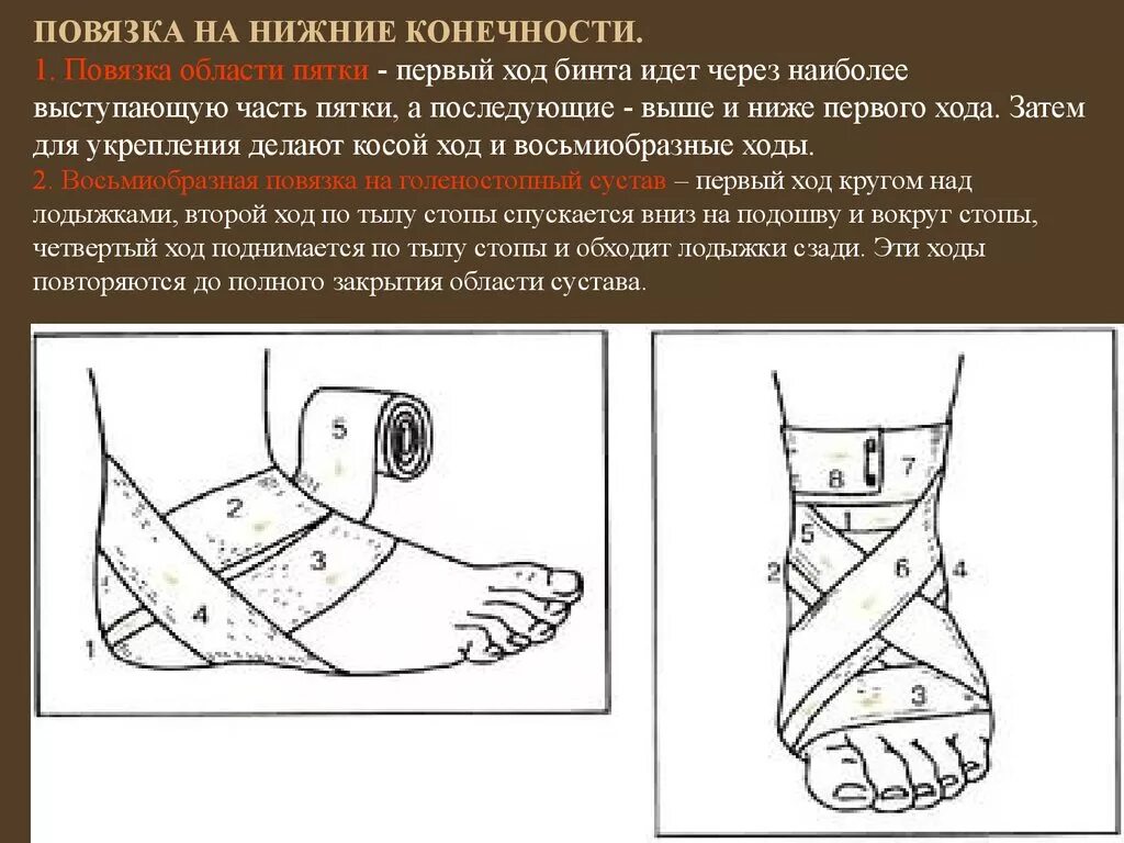 Алгоритм наложения повязки на нижние конечности. Наложение повязки на голеностопный сустав алгоритм. Бинтовая повязка на голеностопный сустав алгоритм. Перевязка эластичным бинтом.