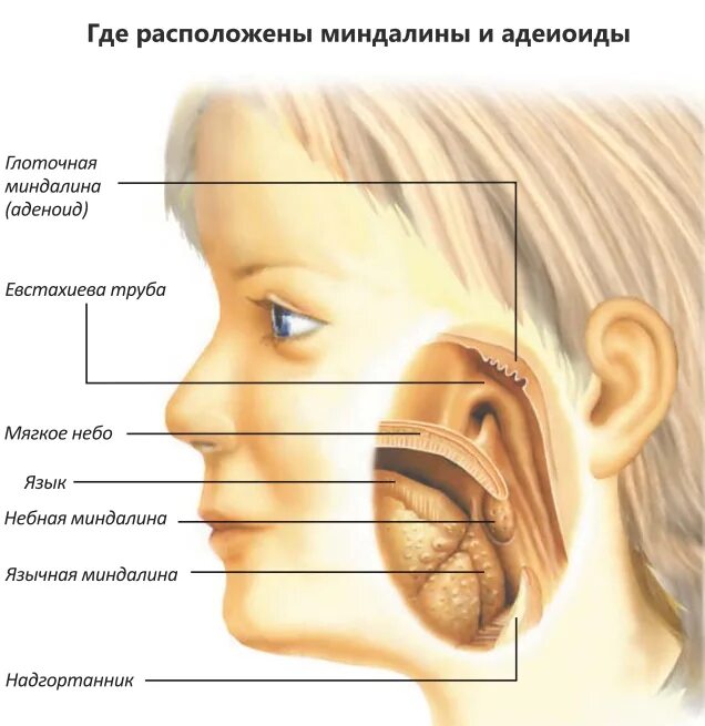 Миндалины аденоиды анатомия. Строение носа аденоидит. Аденоиды у детей строение.