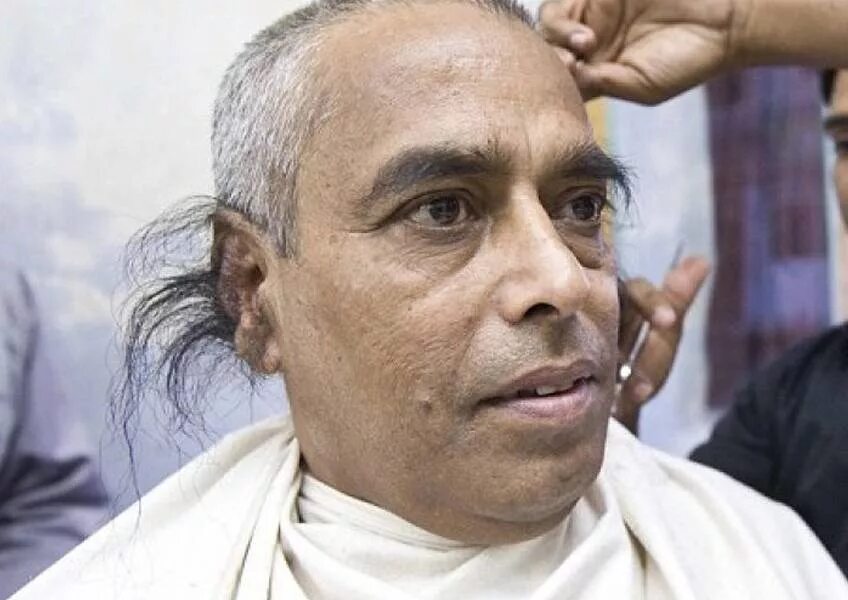 Гипертрихоз ушей. Гипертрихоз ушной раковины. Гипертрихоз ушей. Гипертрихоз ушей. Гипертрихоз ушей.