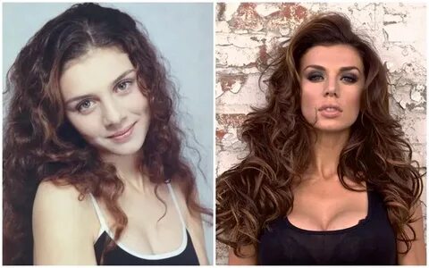 Седакова до и после пластики фото