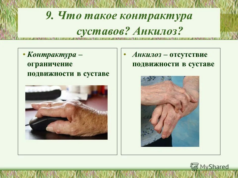 Отсутствие подвижности. Определение экскурсии нижнего края легких. Отсутствие подвижности. Подвижность нижнего легочного края при эмфиземе легких. Отсутствие подвижности.