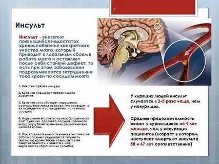 Можно выпивать после инсульта