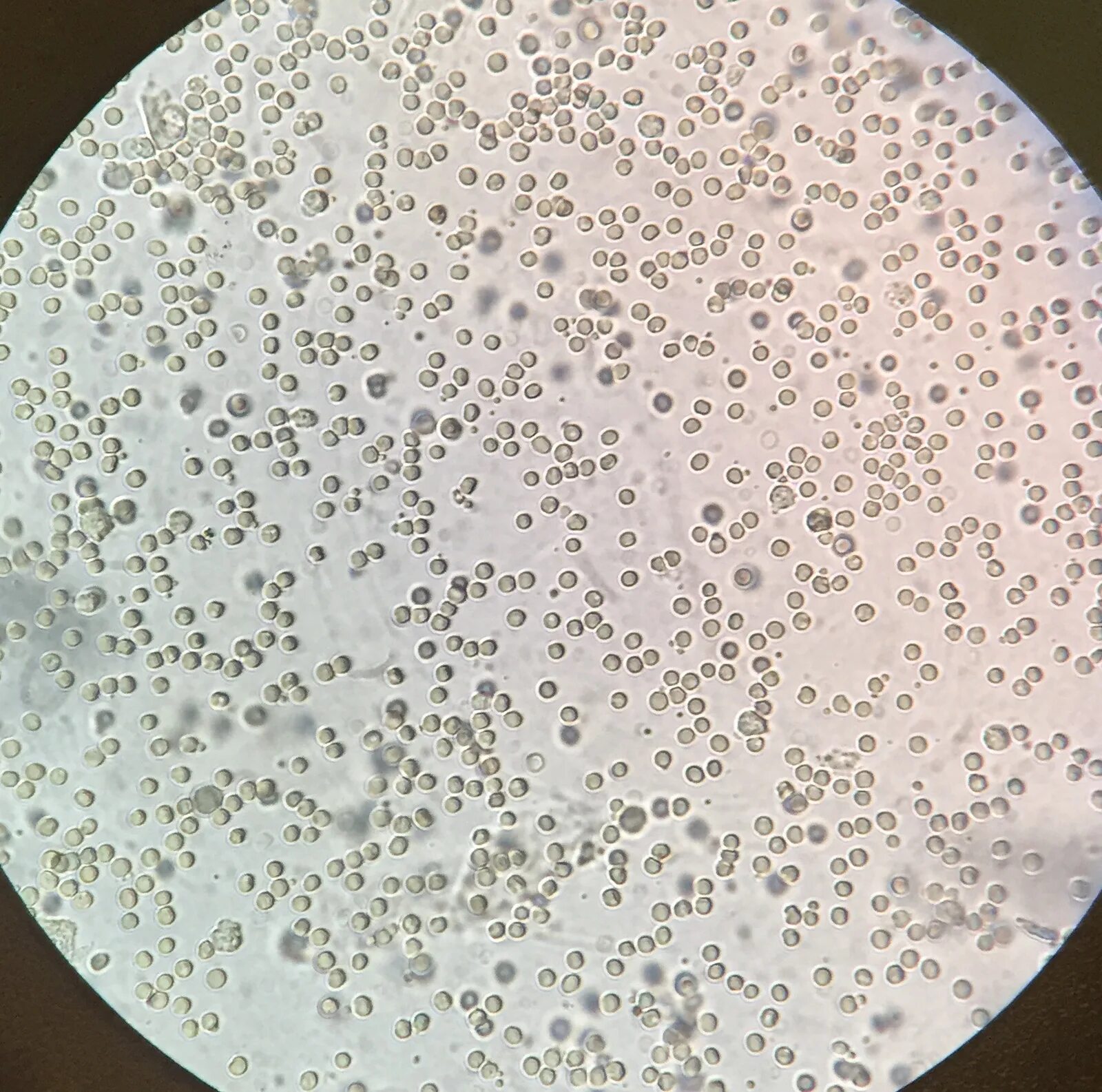 Нечипоренко микроскопия. Эритроциты в моче под микроскопом. Лейкоциты и эритроциты в моче под микроскопом. Моче слизь эритроциты